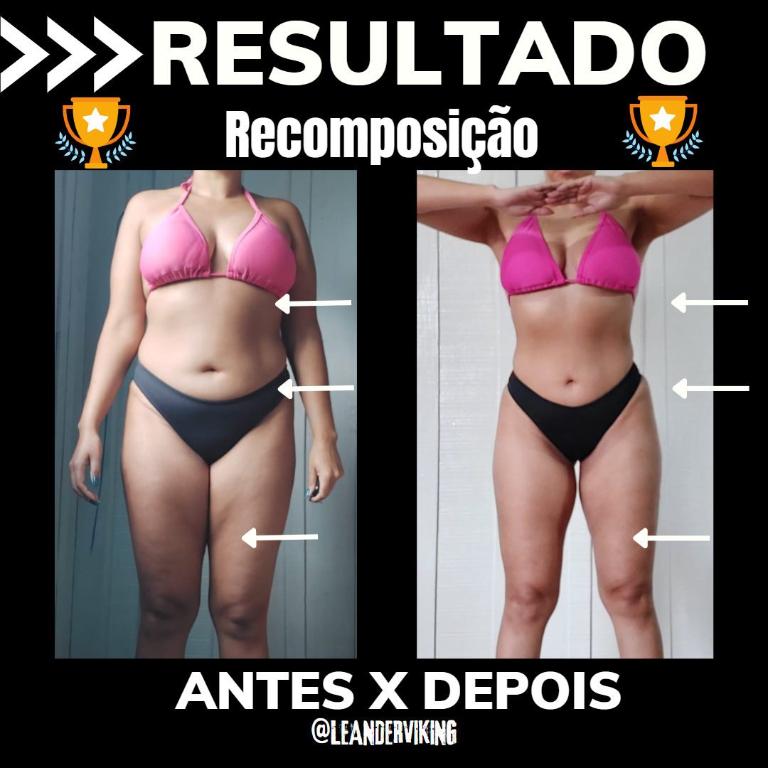 ANA CAROLINA VIEIRA DOS SANTOS AntesXDepois 3