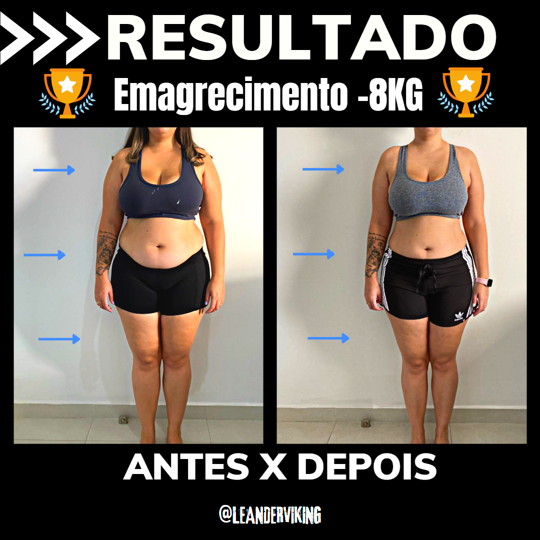 Luisa de Loreto Alves AntesXDepois 1